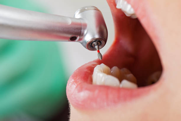 Best Same-Day Emergency Dental Services in Lake Holiday, VA